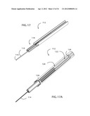 Method for Surgical Stapling diagram and image