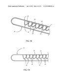 Method for Surgical Stapling diagram and image