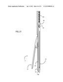 Method for Surgical Stapling diagram and image