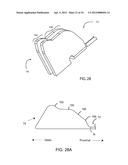 Method for Surgical Stapling diagram and image