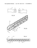 Method for Surgical Stapling diagram and image