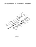 Method for Surgical Stapling diagram and image