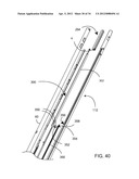 Method for Surgical Stapling diagram and image