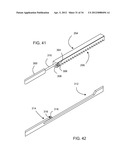 Method for Surgical Stapling diagram and image