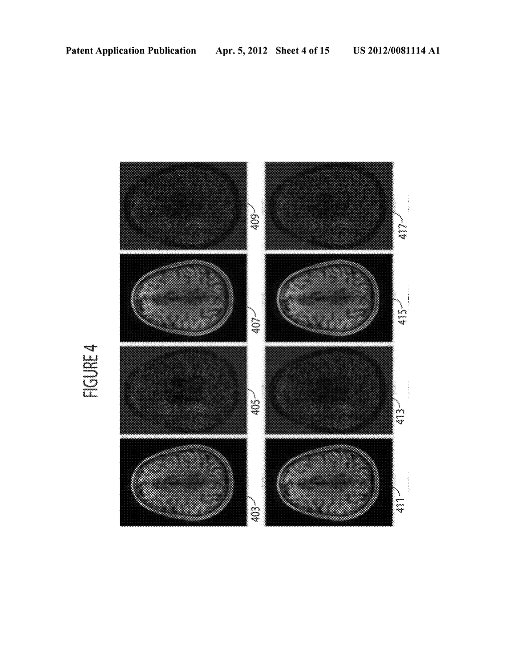 System for Accelerated MR Image Reconstruction - diagram, schematic, and image 05