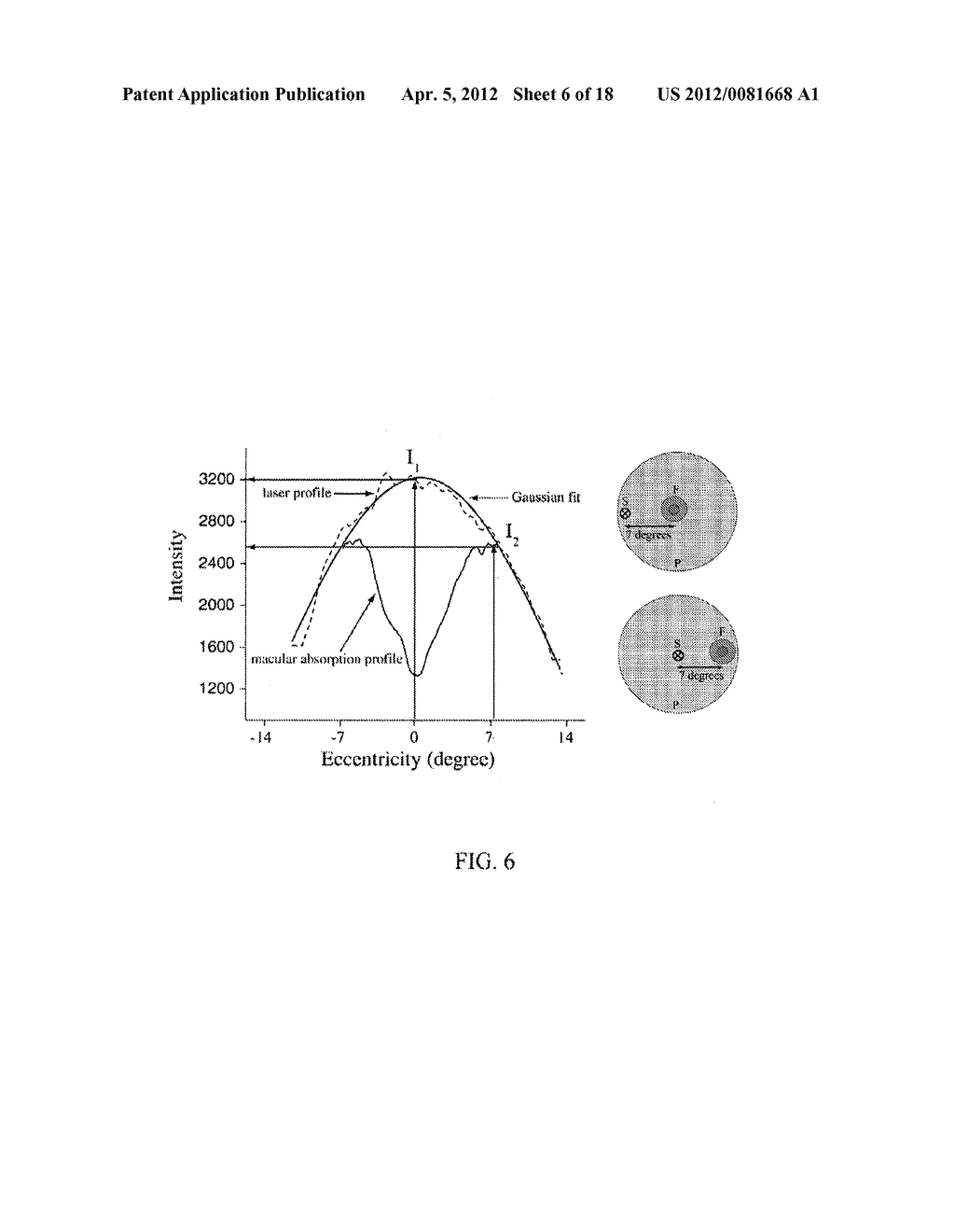 IMAGING OF MACULAR PIGMENT DISTRIBUTIONS - diagram, schematic, and image 07