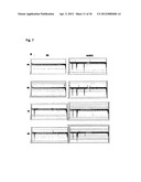 DIAGNOSIS AND TREATMENT OF CELL PROLIFERATION AND DIFFERENTIATION     DISORDERS BASED ON THE FMN2 GENE diagram and image