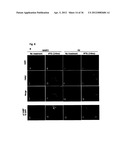 DIAGNOSIS AND TREATMENT OF CELL PROLIFERATION AND DIFFERENTIATION     DISORDERS BASED ON THE FMN2 GENE diagram and image