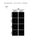 DIAGNOSIS AND TREATMENT OF CELL PROLIFERATION AND DIFFERENTIATION     DISORDERS BASED ON THE FMN2 GENE diagram and image