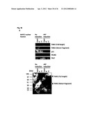 DIAGNOSIS AND TREATMENT OF CELL PROLIFERATION AND DIFFERENTIATION     DISORDERS BASED ON THE FMN2 GENE diagram and image