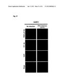 DIAGNOSIS AND TREATMENT OF CELL PROLIFERATION AND DIFFERENTIATION     DISORDERS BASED ON THE FMN2 GENE diagram and image