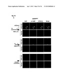 DIAGNOSIS AND TREATMENT OF CELL PROLIFERATION AND DIFFERENTIATION     DISORDERS BASED ON THE FMN2 GENE diagram and image