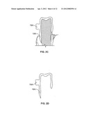 SYSTEMS AND METHODS FOR INTRA-ORAL DRUG DELIVERY diagram and image