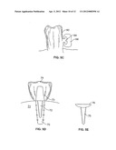 SYSTEMS AND METHODS FOR INTRA-ORAL DRUG DELIVERY diagram and image