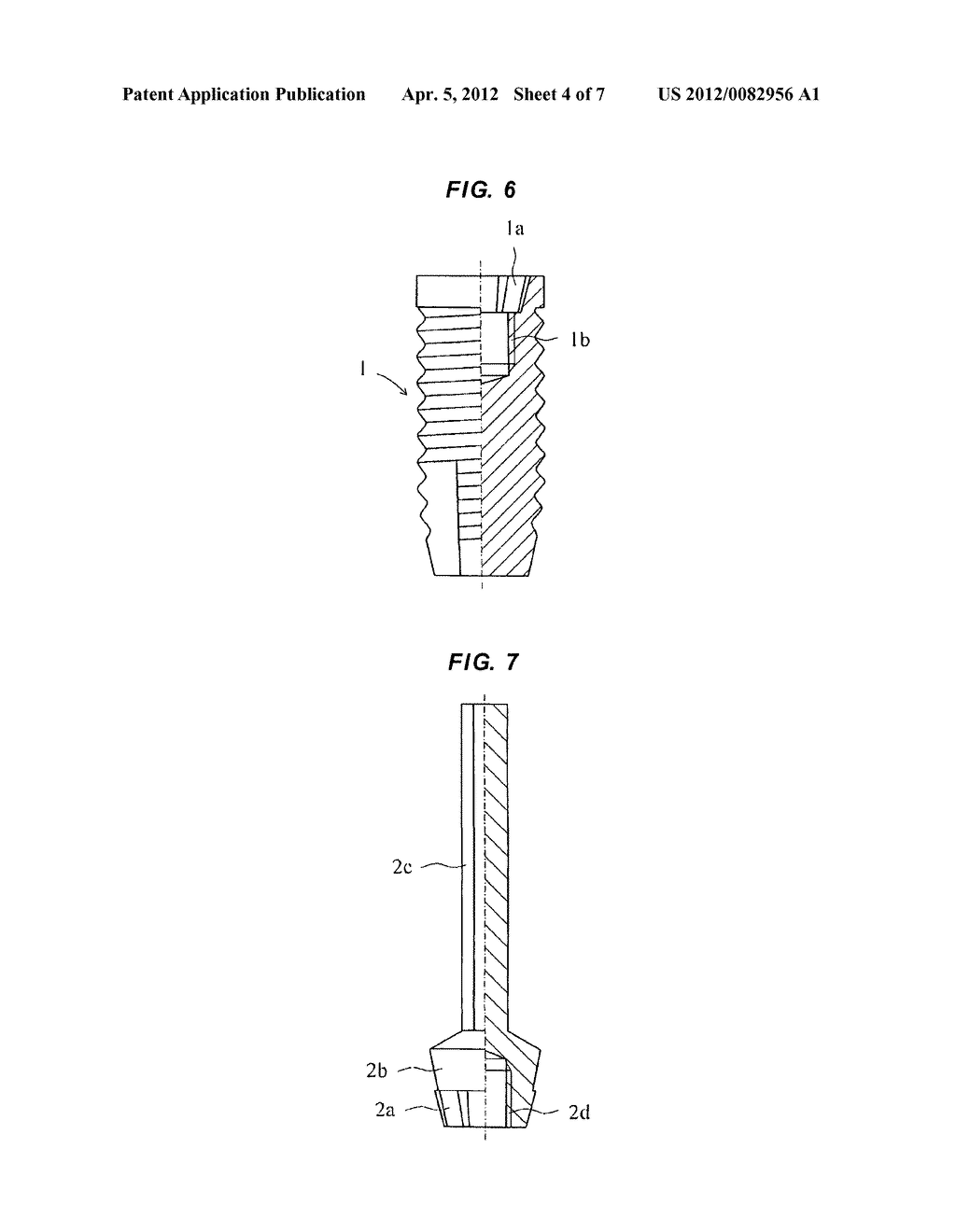 DENTAL IMPLANTS - diagram, schematic, and image 05