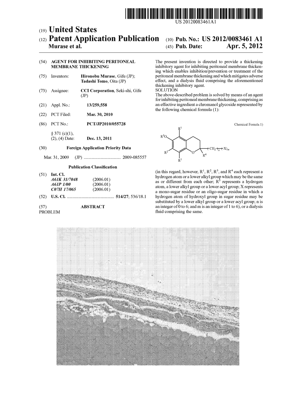 AGENT FOR INHIBITING PERITONEAL MEMBRANE THICKENING - diagram, schematic, and image 01