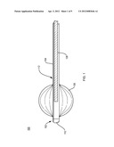 Using a Guide Member to Facilitate Brachytherapy Device Swap diagram and image