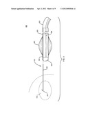 Using a Guide Member to Facilitate Brachytherapy Device Swap diagram and image