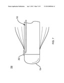 Using a Guide Member to Facilitate Brachytherapy Device Swap diagram and image