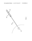 Using a Guide Member to Facilitate Brachytherapy Device Swap diagram and image