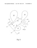 SURGICAL IMPLANT AND METHODS OF USE diagram and image