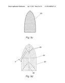 SURGICAL IMPLANT AND METHODS OF USE diagram and image