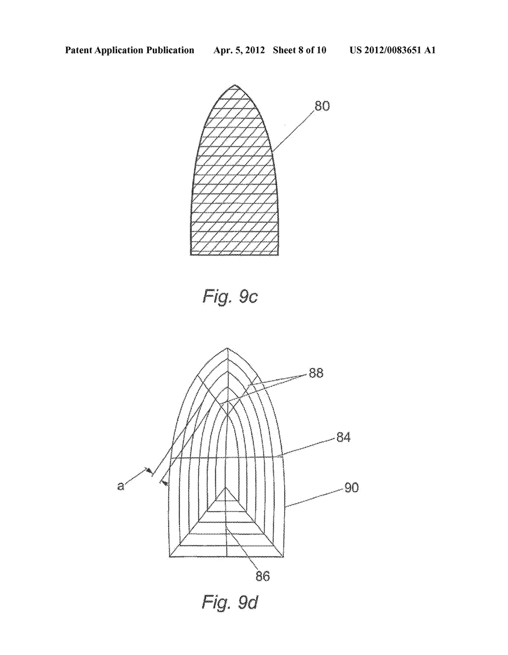 SURGICAL IMPLANT AND METHODS OF USE - diagram, schematic, and image 09