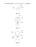 SURGICAL IMPLANT AND METHODS OF USE diagram and image