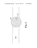 LIGHT-GUIDED TRANSLUMINAL CATHETER diagram and image