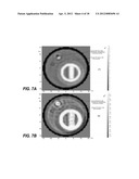 SYSTEM AND METHOD FOR ELECTROMAGNETIC IMAGING AND THERAPEUTICS USING     SPECIALIZED NANOPARTICLES diagram and image