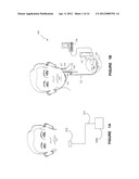 DETECTING, QUANTIFYING, AND/OR CLASSIFYING SEIZURES USING MULTIMODAL DATA diagram and image