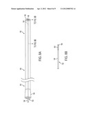 Method for Locating a Catheter Tip Using Audio Detection diagram and image