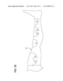 Monitoring Compliance Using Venous Refill Detection diagram and image