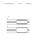 BALLOON CATHETER COMPRISING PRESSURE SENSITIVE MICROPARTICLES diagram and image