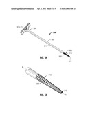 Introducer Sheath for Catheters diagram and image