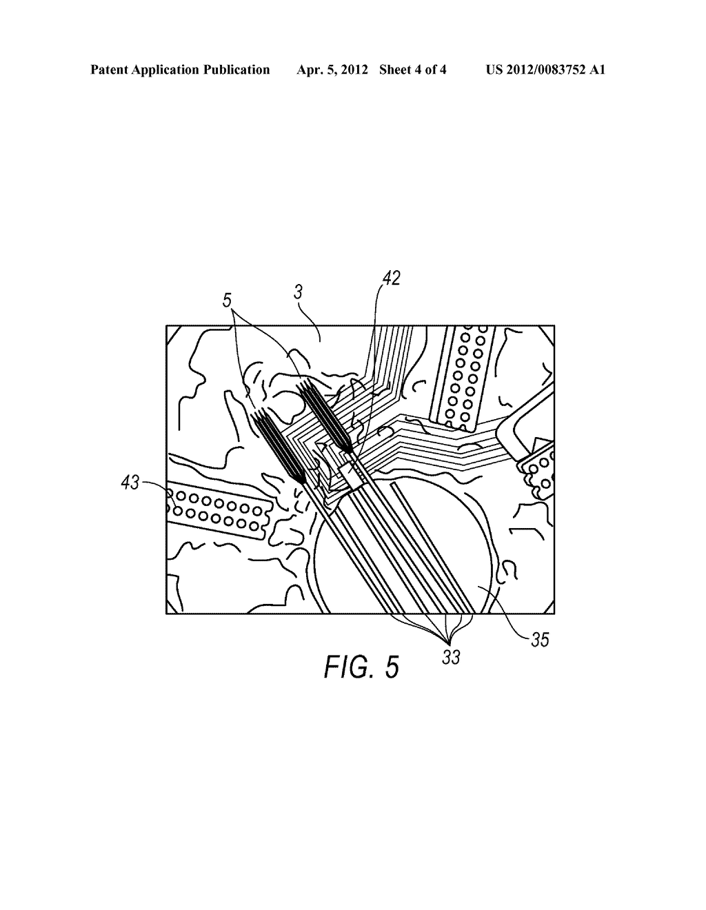 INTRACRANIAL NEURAL INTERFACE SYSTEM - diagram, schematic, and image 05