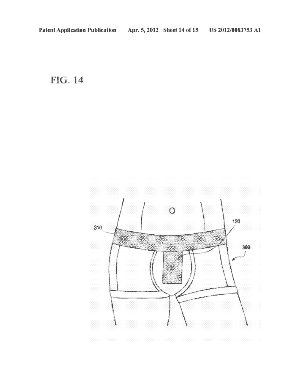 FABRIC AND FABRIC PRODUCT PROVIDED WITH SCORIA MOLDED BODY, AND METHOD FOR     ADHERING SCORIA - diagram, schematic, and image 15