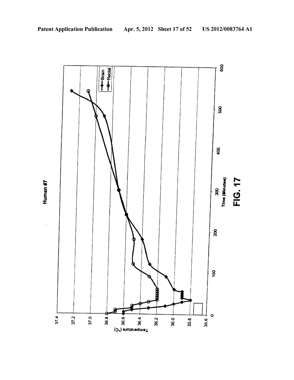 METHODS AND DEVICES FOR TREATMENT OF MIGRAINES - diagram, schematic, and image 18