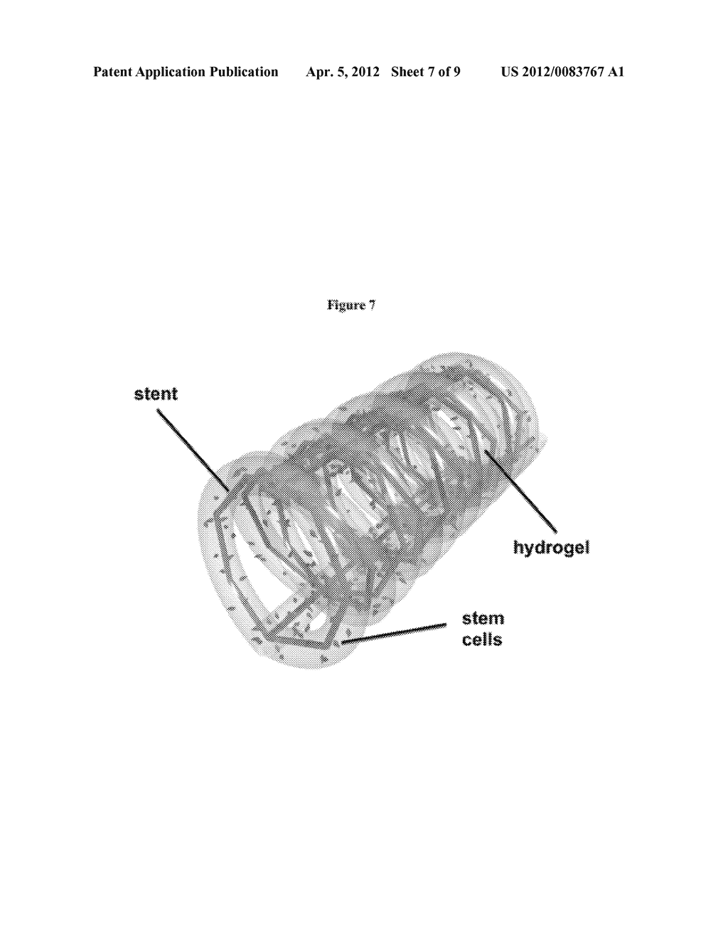 IMPLANTABLE BIOREACTOR FOR DELIVERY OF PARACRINE FACTORS - diagram, schematic, and image 08