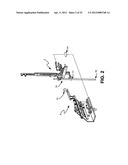 DETACHABLE HANDLE MECHANISM FOR USE IN INSTRUMENT POSITIONING diagram and image