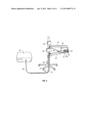 CORNEAL TREATMENT SYSTEM AND METHOD diagram and image