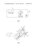 CORNEAL TREATMENT SYSTEM AND METHOD diagram and image