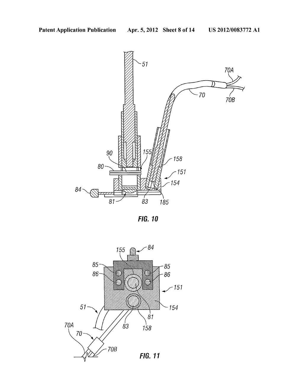 CORNEAL TREATMENT SYSTEM AND METHOD - diagram, schematic, and image 09