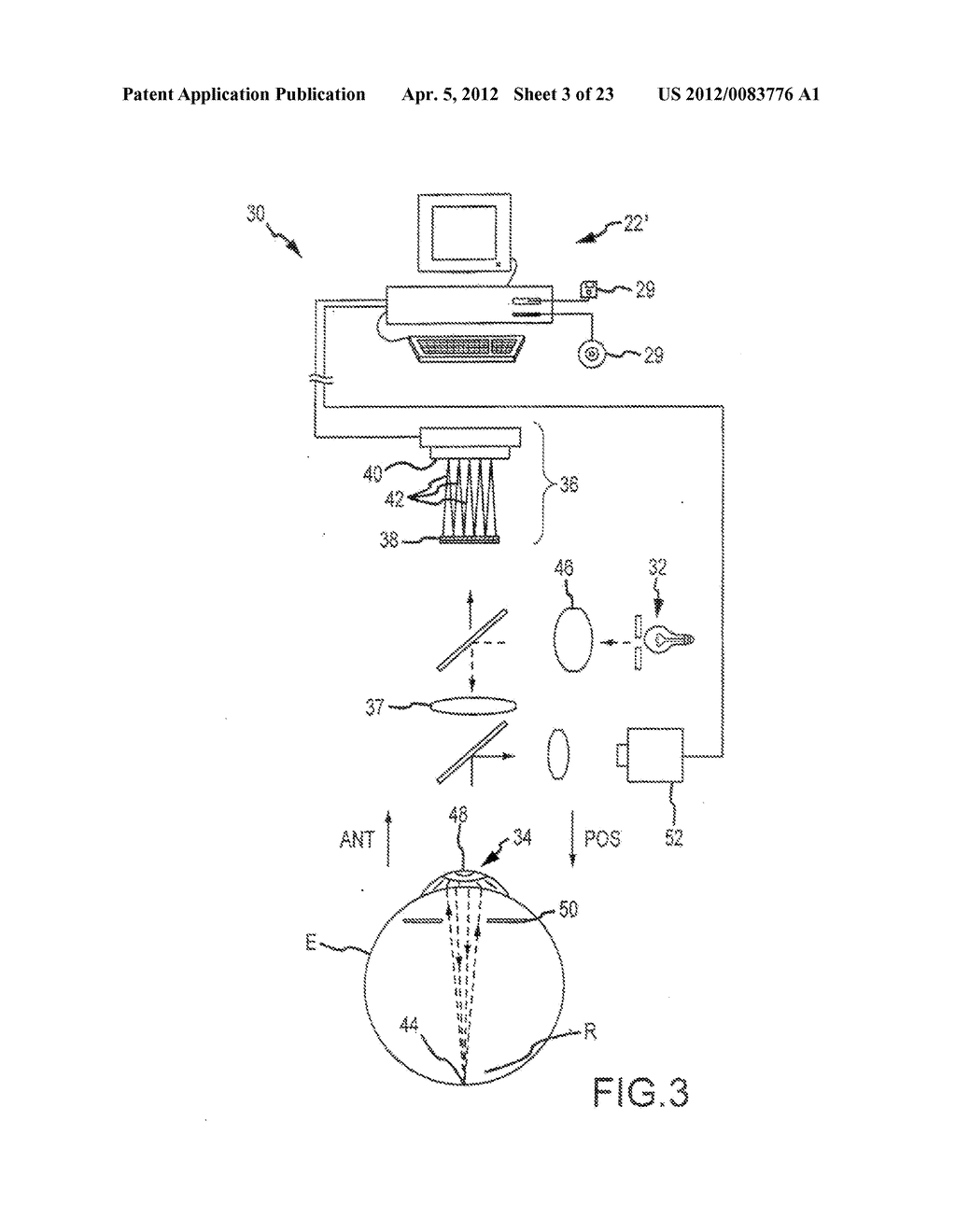 ANNULAR AND OTHER ABLATION PROFILES FOR REFRACTIVE SURGERY SYSTEMS AND     METHODS - diagram, schematic, and image 04