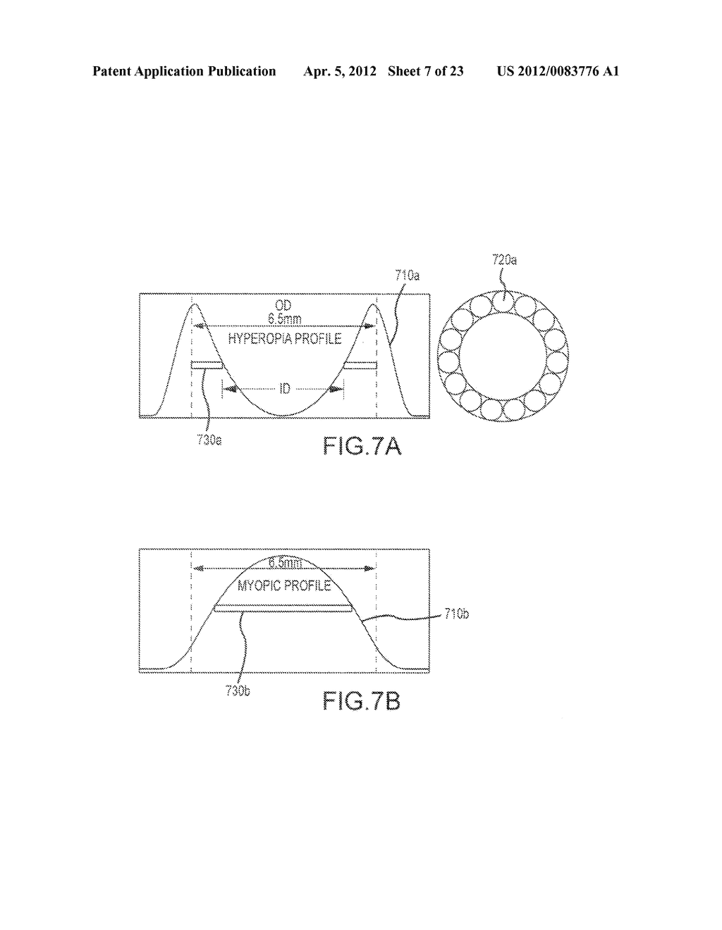 ANNULAR AND OTHER ABLATION PROFILES FOR REFRACTIVE SURGERY SYSTEMS AND     METHODS - diagram, schematic, and image 08