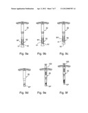 IMPLEMENT FOR ORIENTATING A TOOL, PARTICULARLY USEFUL IN SURGICAL TOOLS     FOR HARVESTING AND IMPLANTING BONE PLUGS TO REPAIR DAMAGED BONE TISSUE diagram and image