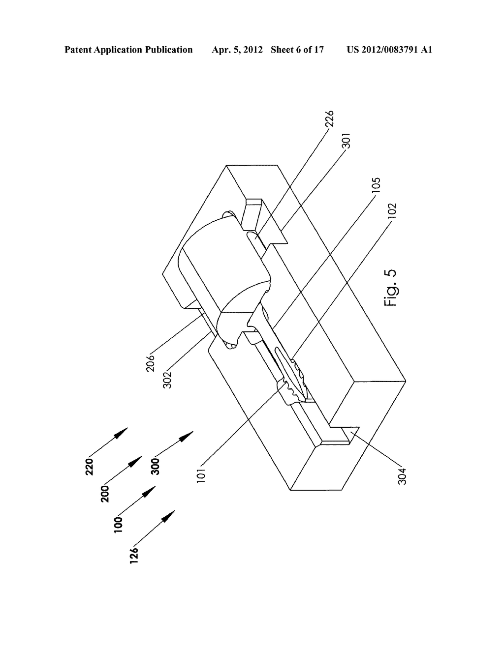 Method and system for storing and inserting an implant - diagram, schematic, and image 07