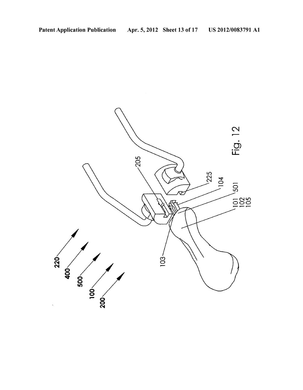 Method and system for storing and inserting an implant - diagram, schematic, and image 14