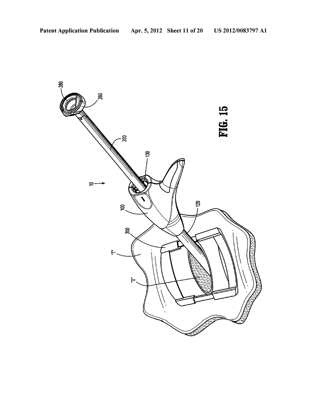 SURGICAL RETRIEVAL APPARATUS - diagram, schematic, and image 12