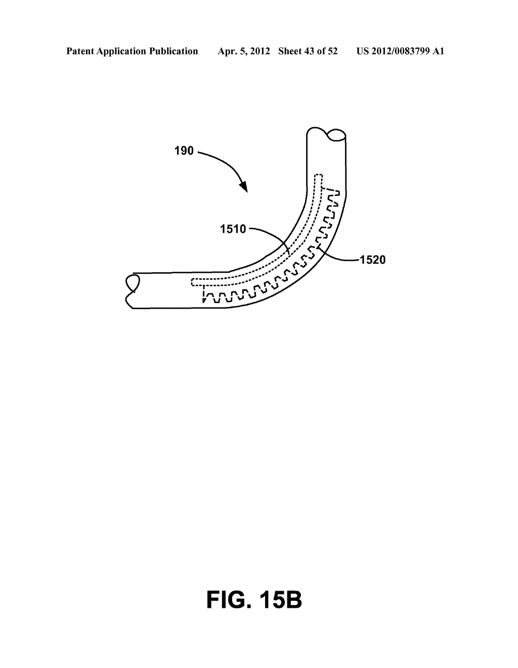 INTERFACE MECHANISM BETWEEN A DETACHABLE SHAFT AND A STERILIZING DRAPE - diagram, schematic, and image 44